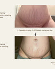 Belly Oil