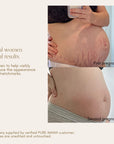 Belly Oil
