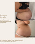 Belly Oil
