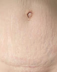 C-Section Mama Cream