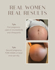 Belly Oil