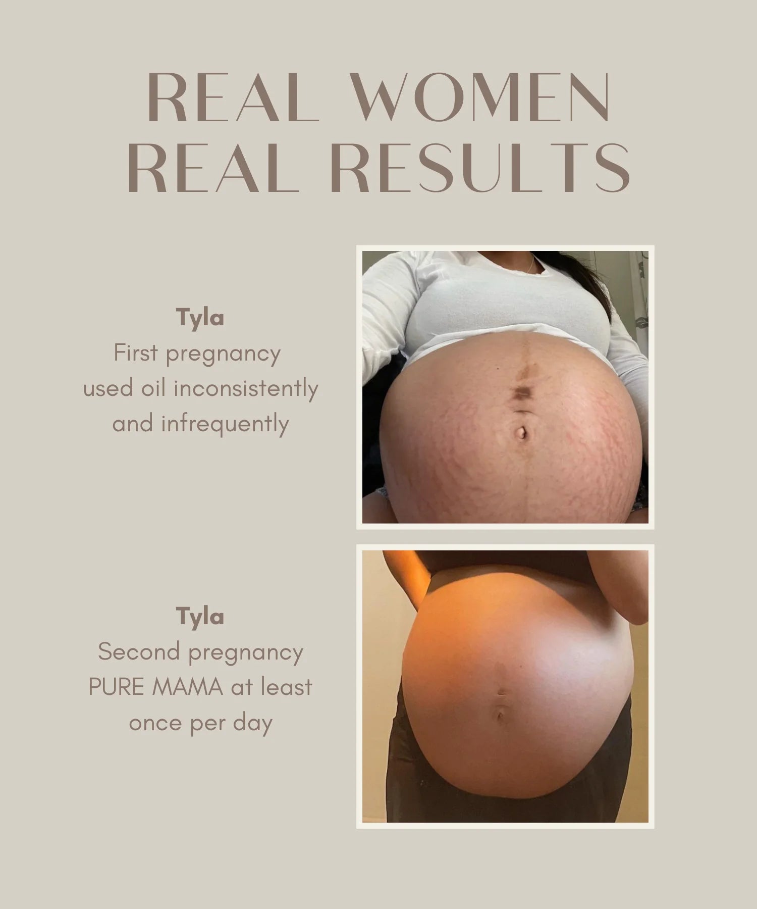 Belly Oil